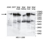 PITRM1 Antibody from Signalway Antibody (39736) - Antibodies.com