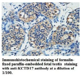 KCTD17 Antibody from Signalway Antibody (39739) - Antibodies.com