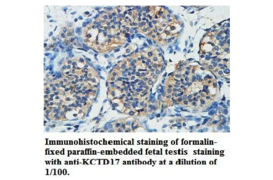 KCTD17 Antibody from Signalway Antibody (39739) - Antibodies.com