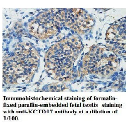 KCTD17 Antibody from Signalway Antibody (39739) - Antibodies.com