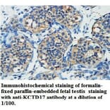 KCTD17 Antibody from Signalway Antibody (39739) - Antibodies.com