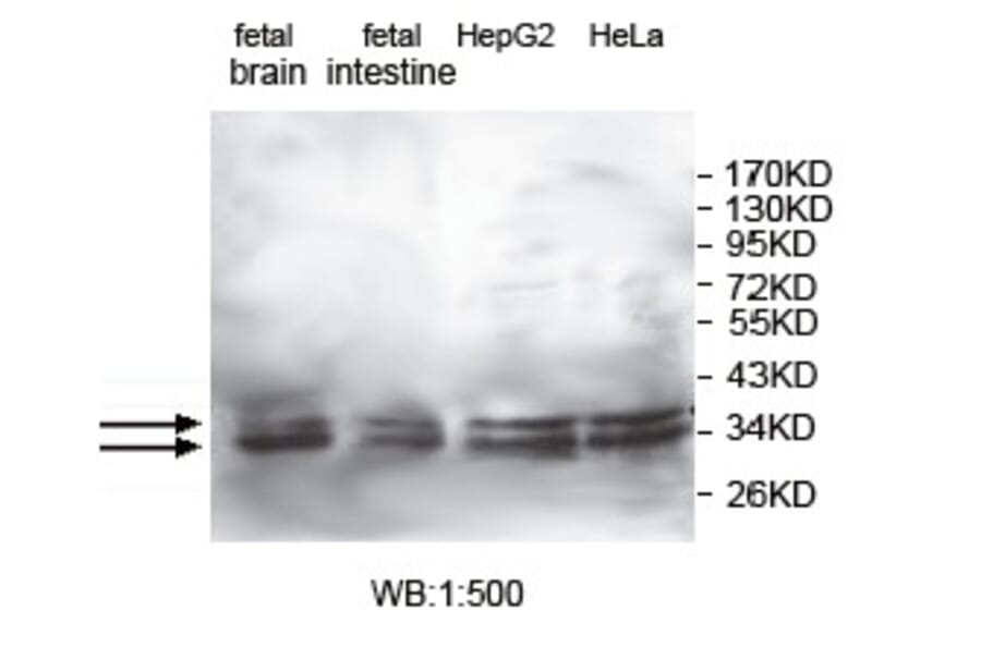 KCTD17 Antibody from Signalway Antibody (39739) - Antibodies.com