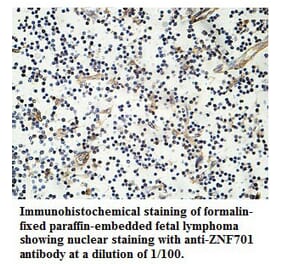 ZNF701 Antibody from Signalway Antibody (39761) - Antibodies.com