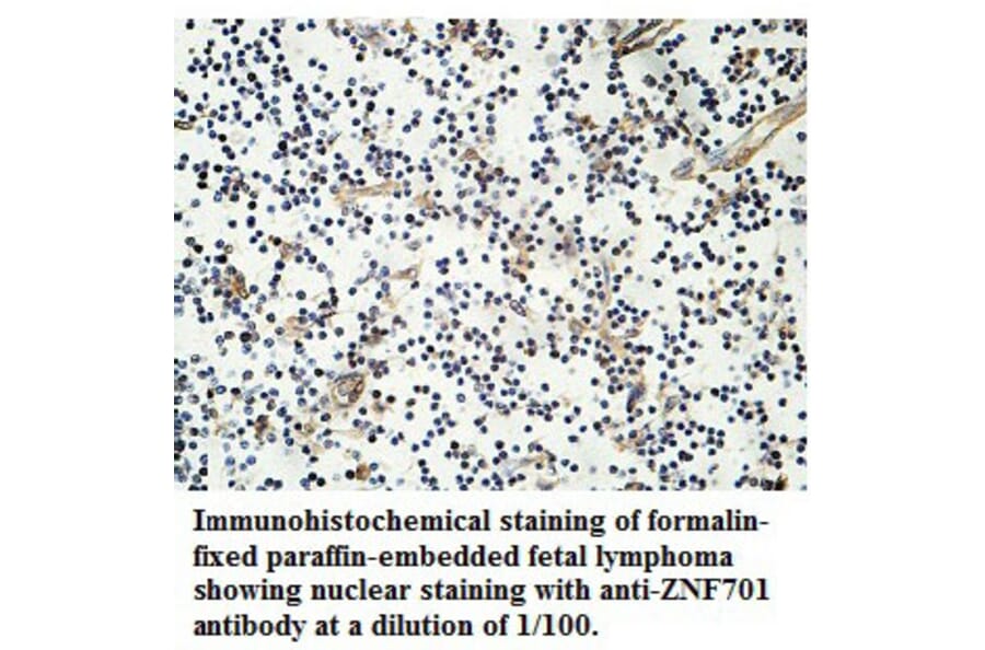 ZNF701 Antibody from Signalway Antibody (39761) - Antibodies.com