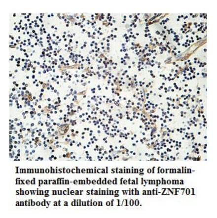 ZNF701 Antibody from Signalway Antibody (39761) - Antibodies.com