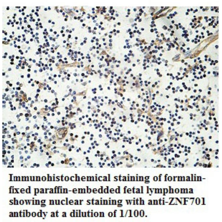ZNF701 Antibody from Signalway Antibody (39761) - Antibodies.com
