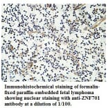 ZNF701 Antibody from Signalway Antibody (39761) - Antibodies.com
