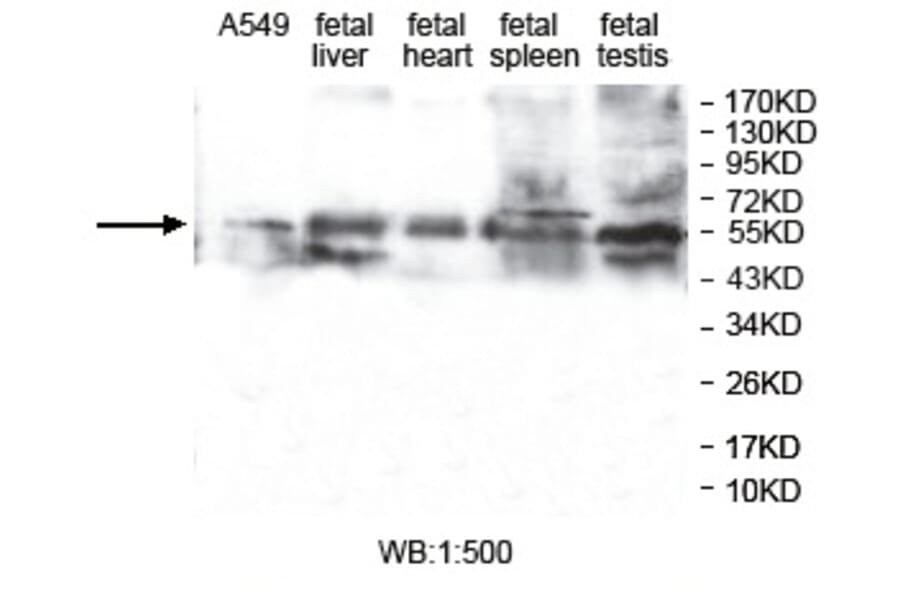 ZNF701 Antibody from Signalway Antibody (39761) - Antibodies.com