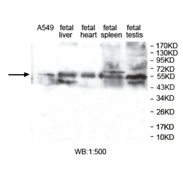 ZNF701 Antibody from Signalway Antibody (39761) - Antibodies.com