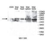 ZNF701 Antibody from Signalway Antibody (39761) - Antibodies.com