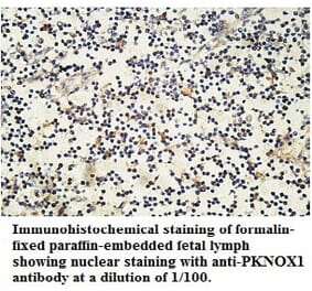 PKNOX1 Antibody from Signalway Antibody (39762) - Antibodies.com