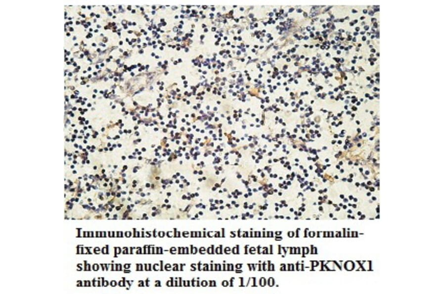 PKNOX1 Antibody from Signalway Antibody (39762) - Antibodies.com
