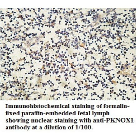 PKNOX1 Antibody from Signalway Antibody (39762) - Antibodies.com