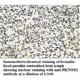 PKNOX1 Antibody from Signalway Antibody (39762) - Antibodies.com