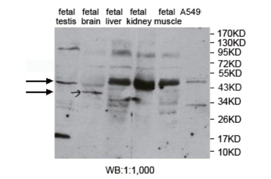 PKNOX1 Antibody from Signalway Antibody (39762) - Antibodies.com
