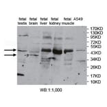 PKNOX1 Antibody from Signalway Antibody (39762) - Antibodies.com