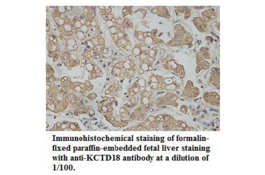 KCTD18 Antibody from Signalway Antibody (39763) - Antibodies.com