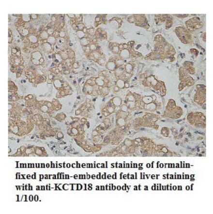 KCTD18 Antibody from Signalway Antibody (39763) - Antibodies.com