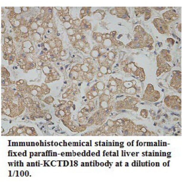 KCTD18 Antibody from Signalway Antibody (39763) - Antibodies.com