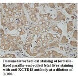 KCTD18 Antibody from Signalway Antibody (39763) - Antibodies.com