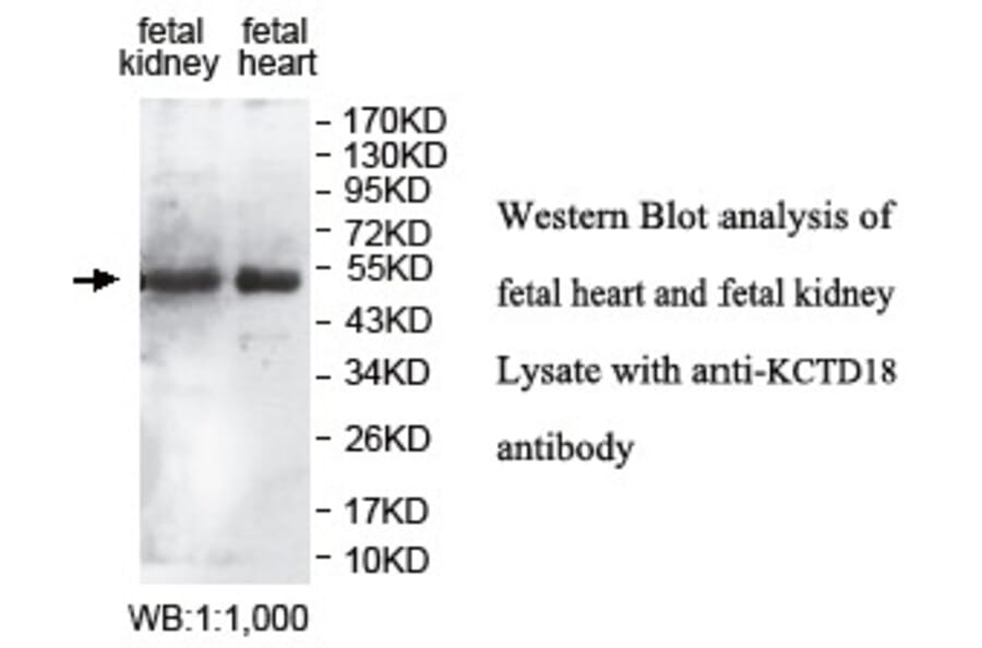 KCTD18 Antibody from Signalway Antibody (39763) - Antibodies.com
