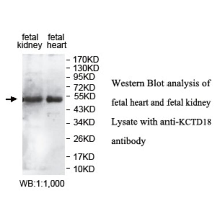KCTD18 Antibody from Signalway Antibody (39763) - Antibodies.com