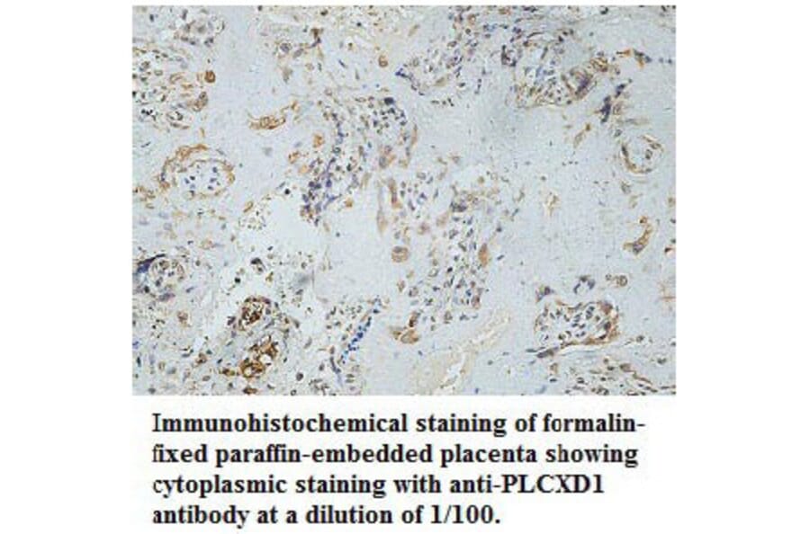 PLCXD1 Antibody from Signalway Antibody (39766) - Antibodies.com