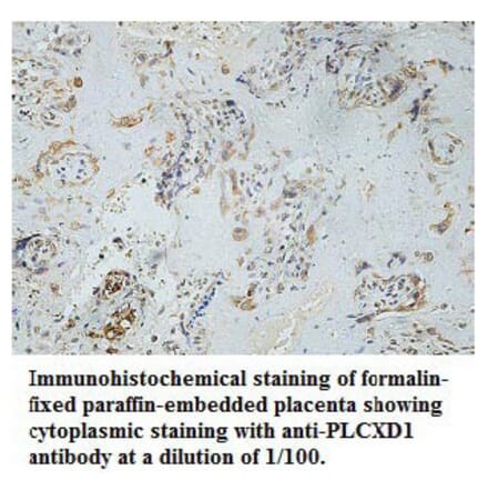 PLCXD1 Antibody from Signalway Antibody (39766) - Antibodies.com