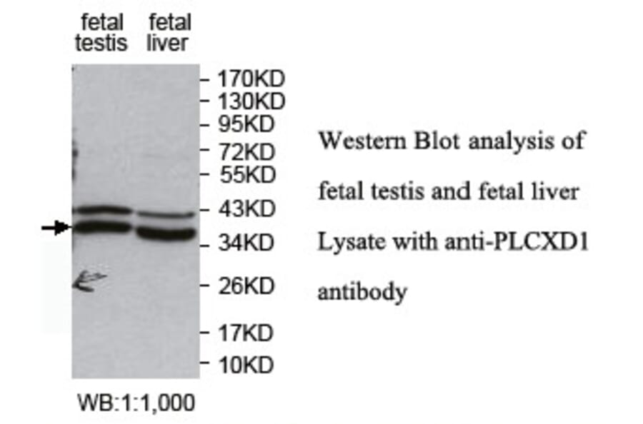 PLCXD1 Antibody from Signalway Antibody (39766) - Antibodies.com