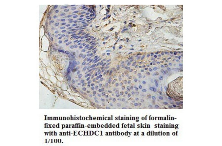 ECHDC1 Antibody from Signalway Antibody (39768) - Antibodies.com