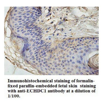ECHDC1 Antibody from Signalway Antibody (39768) - Antibodies.com