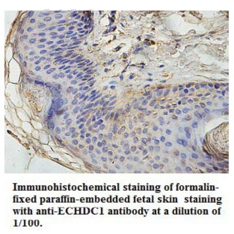 ECHDC1 Antibody from Signalway Antibody (39768) - Antibodies.com