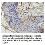 ECHDC1 Antibody from Signalway Antibody (39768) - Antibodies.com