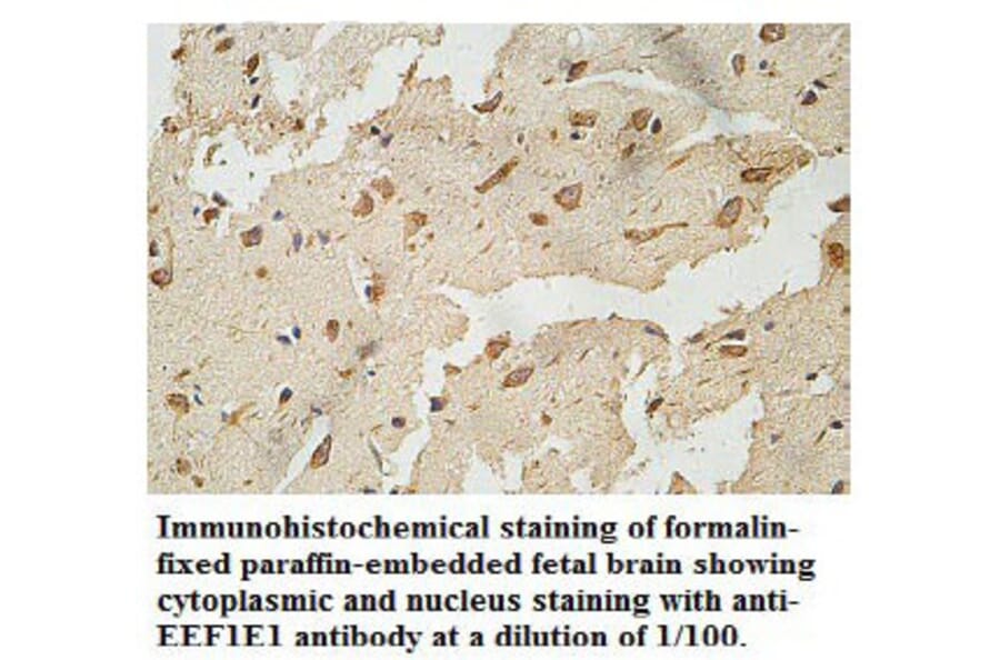 EEF1E1 Antibody from Signalway Antibody (39770) - Antibodies.com