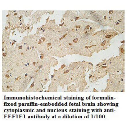 EEF1E1 Antibody from Signalway Antibody (39770) - Antibodies.com