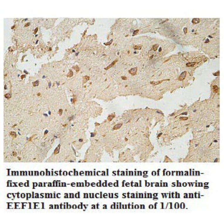 EEF1E1 Antibody from Signalway Antibody (39770) - Antibodies.com