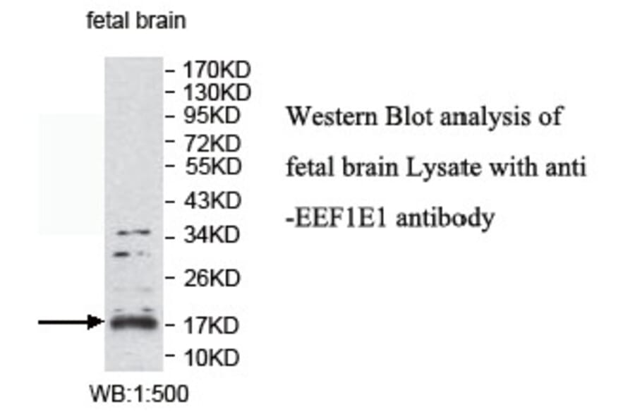 EEF1E1 Antibody from Signalway Antibody (39770) - Antibodies.com
