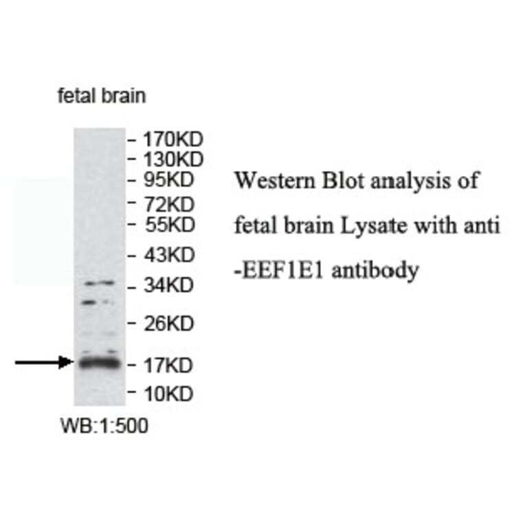 EEF1E1 Antibody from Signalway Antibody (39770) - Antibodies.com