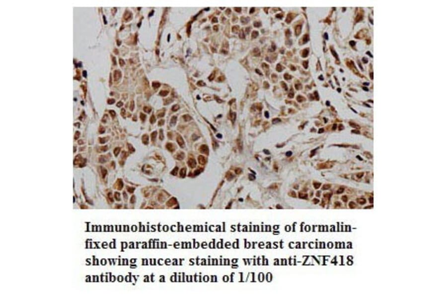 ZNF418 Antibody from Signalway Antibody (39774) - Antibodies.com