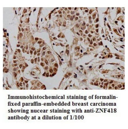 ZNF418 Antibody from Signalway Antibody (39774) - Antibodies.com