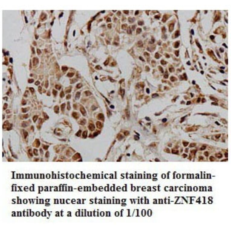 ZNF418 Antibody from Signalway Antibody (39774) - Antibodies.com