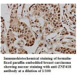 ZNF418 Antibody from Signalway Antibody (39774) - Antibodies.com