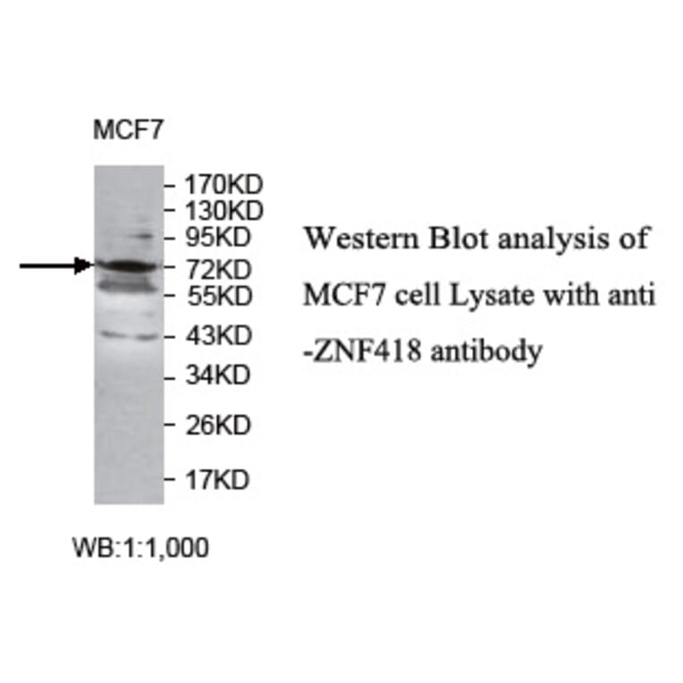 ZNF418 Antibody from Signalway Antibody (39774) - Antibodies.com