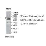 ZNF418 Antibody from Signalway Antibody (39774) - Antibodies.com