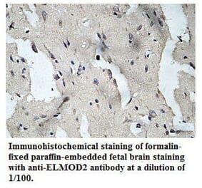 ELMOD2 Antibody from Signalway Antibody (39779) - Antibodies.com