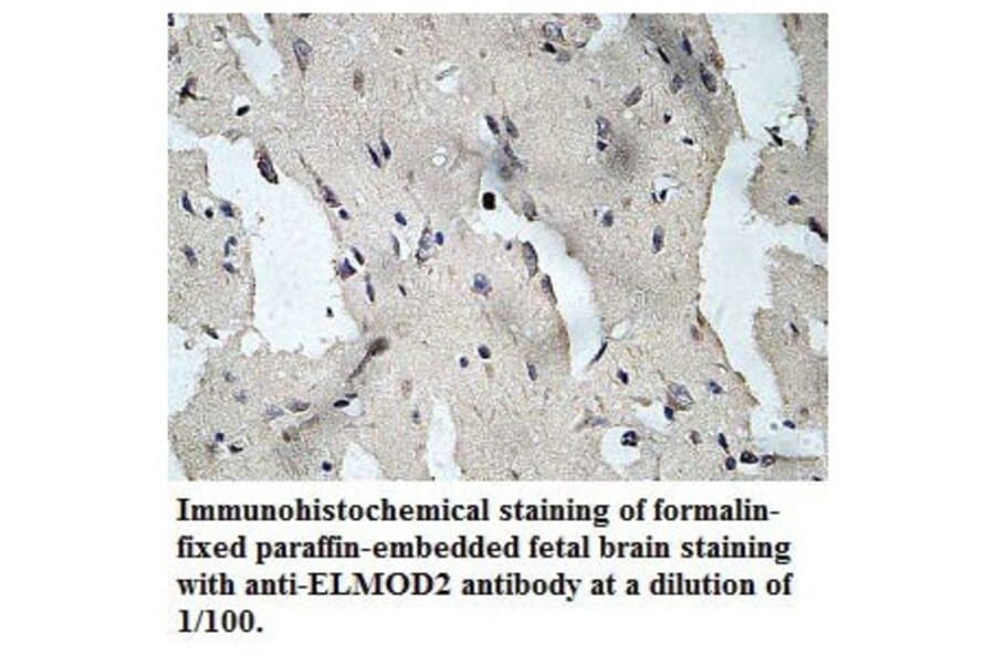 ELMOD2 Antibody from Signalway Antibody (39779) - Antibodies.com