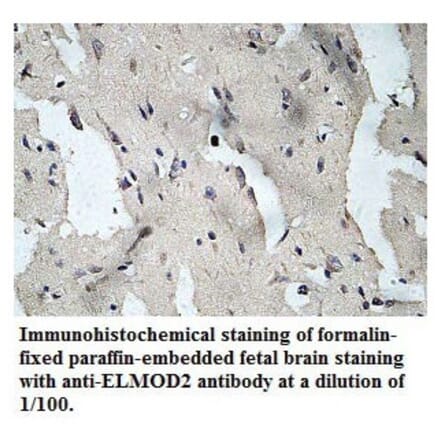 ELMOD2 Antibody from Signalway Antibody (39779) - Antibodies.com