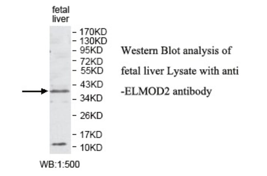 ELMOD2 Antibody from Signalway Antibody (39779) - Antibodies.com