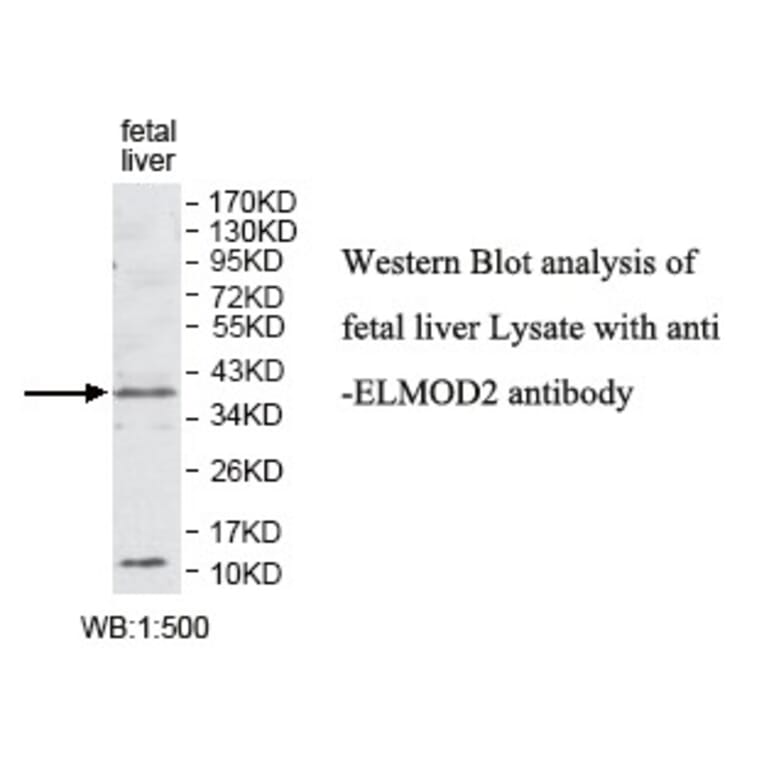 ELMOD2 Antibody from Signalway Antibody (39779) - Antibodies.com