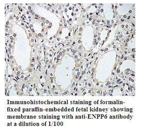 ENTPD1 Antibody from Signalway Antibody (39795) - Antibodies.com